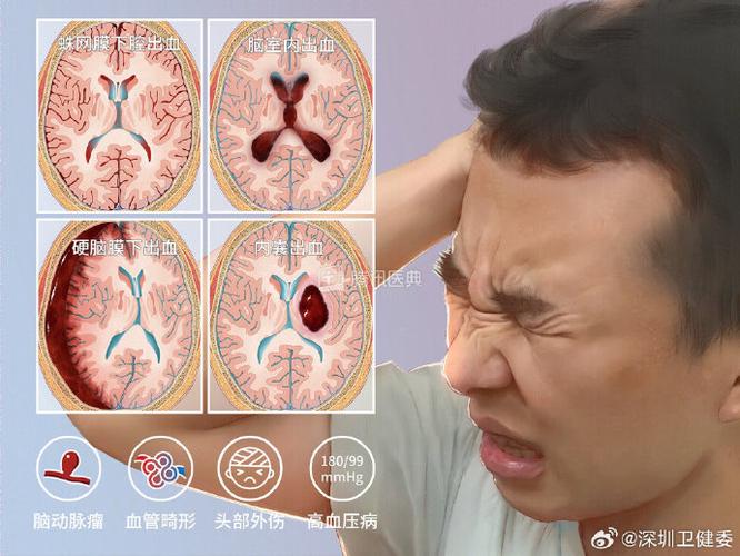 head是哪个部位