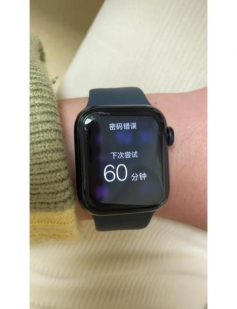 watch忘记密码了怎么办